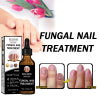 Nail Repair Solution Thickening Brightening Nails Removing Gray Nails Dead Skin Repair Nourishing Nail Care Solution